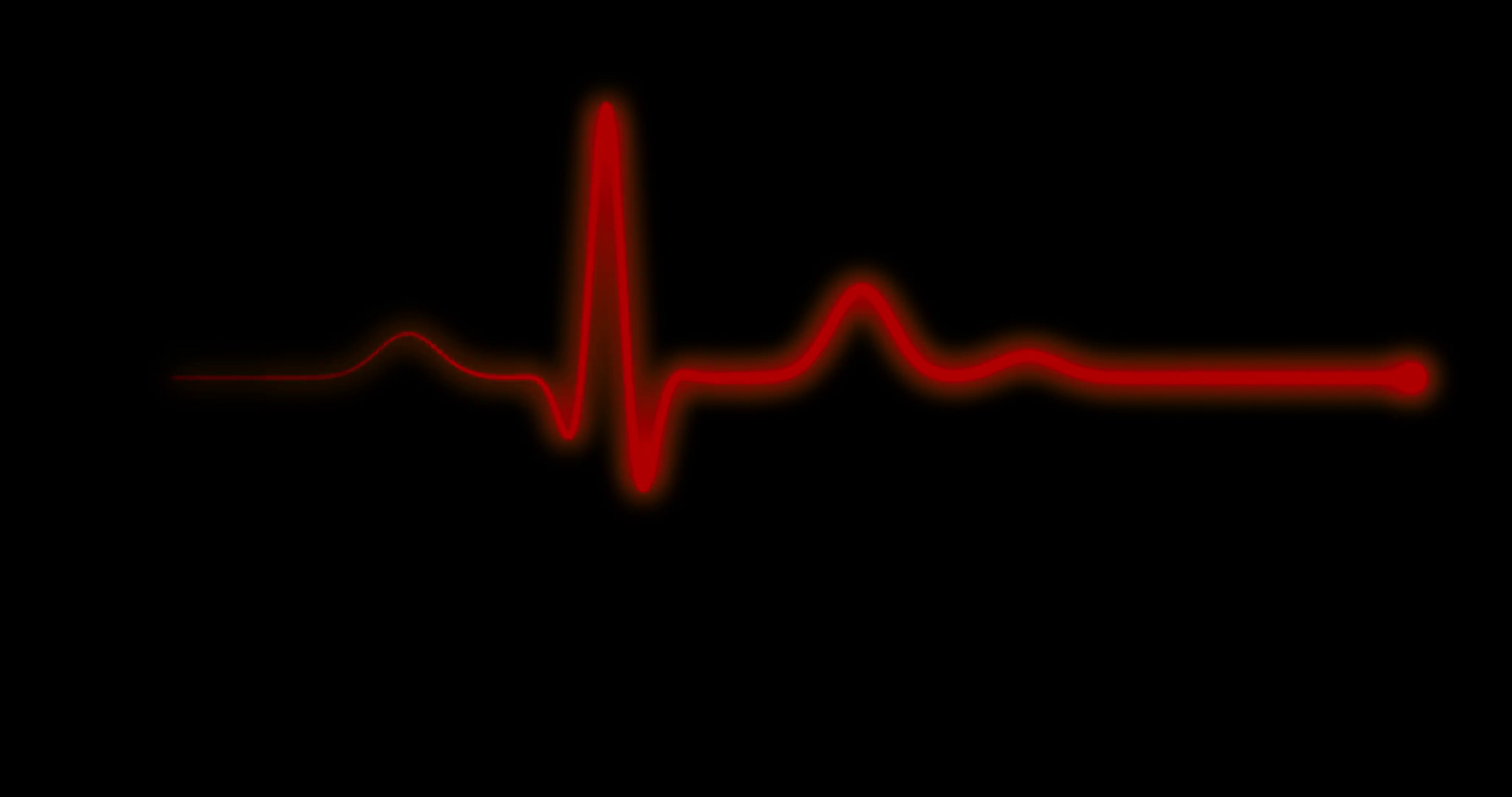 Пульс остановился. Кардиограмма остановки сердца. Остановка сердца на ЭКГ. Пульс остановка сердца. ЭКГ на черном фоне.