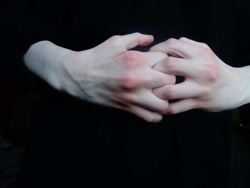 Бледные красивые руки