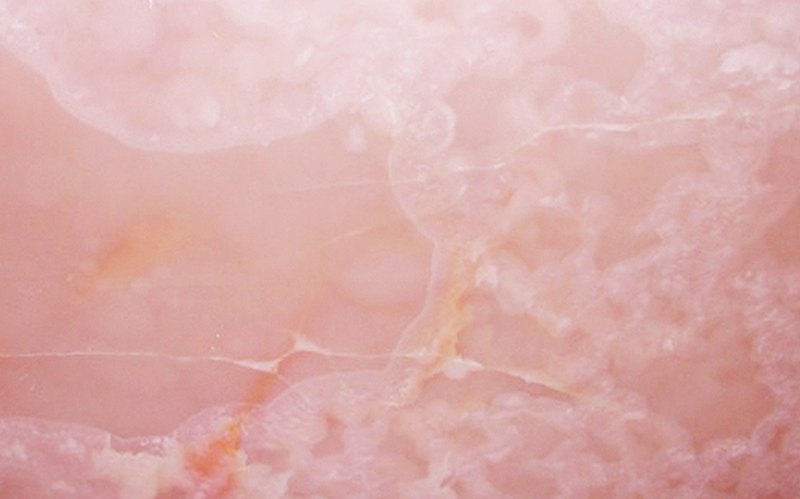 Pink Quartz Onyx