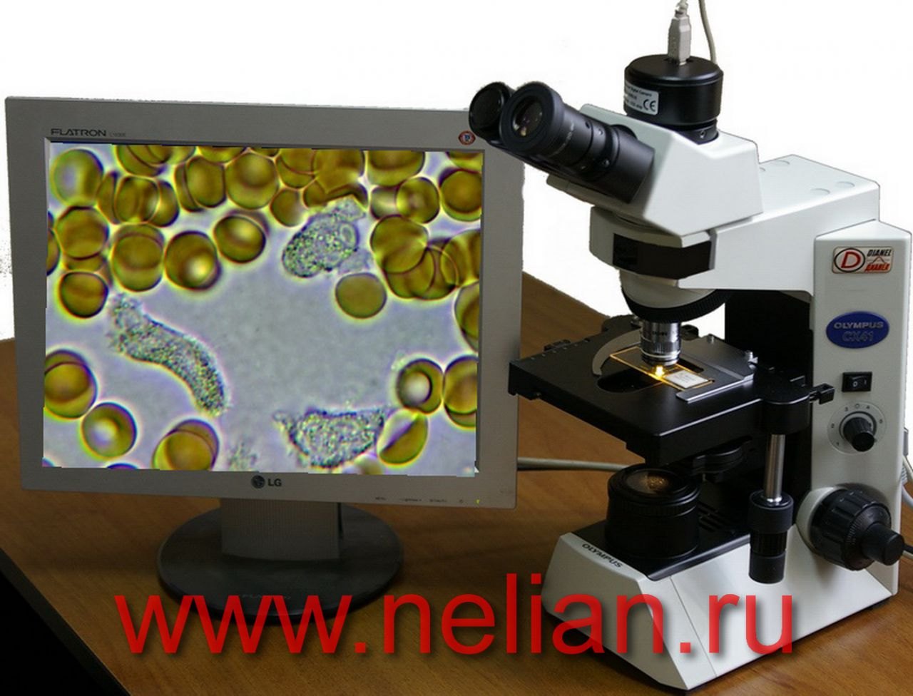 Поле микроскопа. Микроскоп Олимпус СХ 41. Микроскоп Olympus cx41. Темнопольный микроскоп. Микроскоп цифровой биологический лабораторный 1мп.