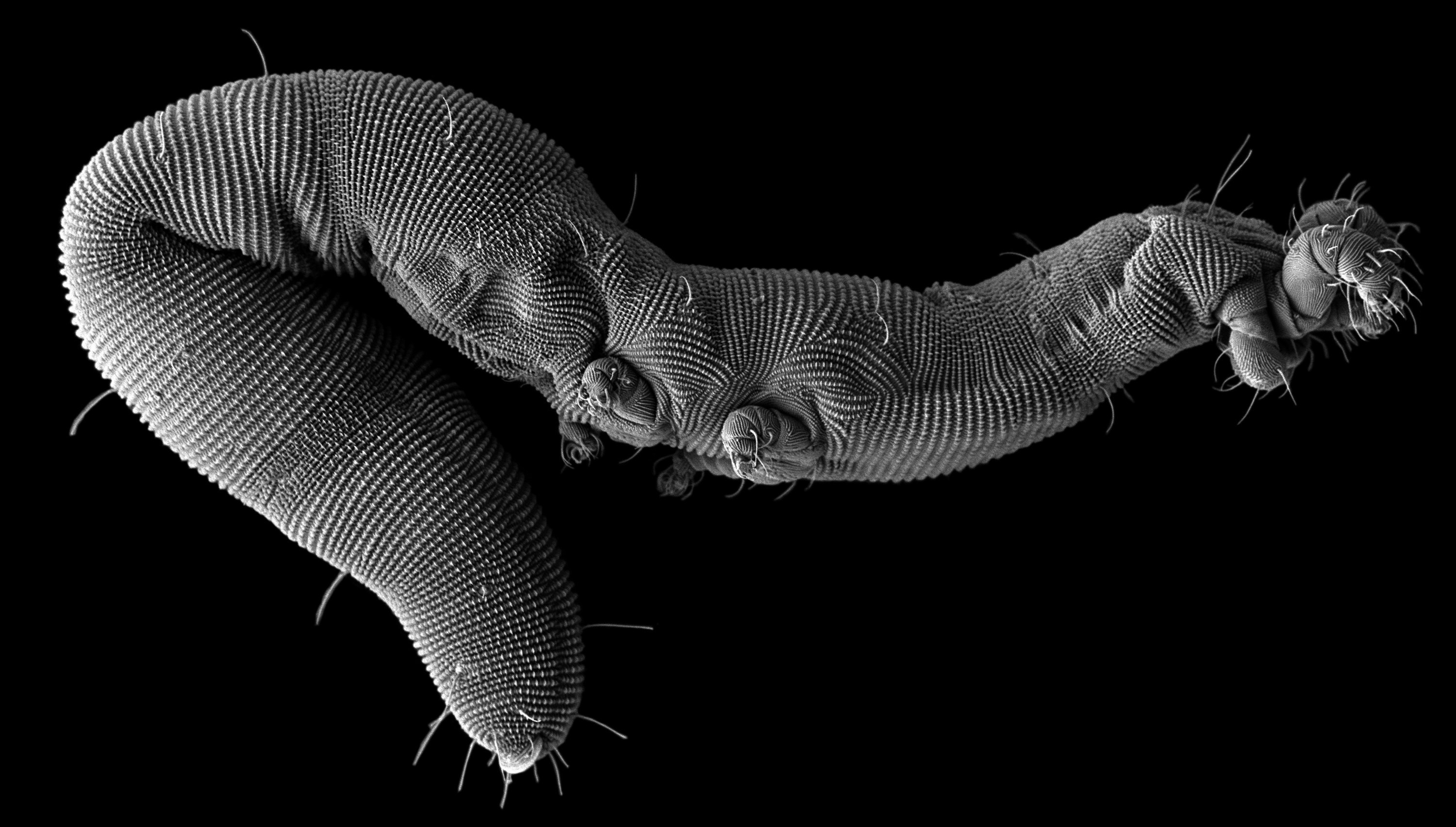 Стволовой червь. Микрофотография дождевого червя. Кольчатые черви микроскоп. Тихоходка микрофотография. Кольчатый червь микроскоп.